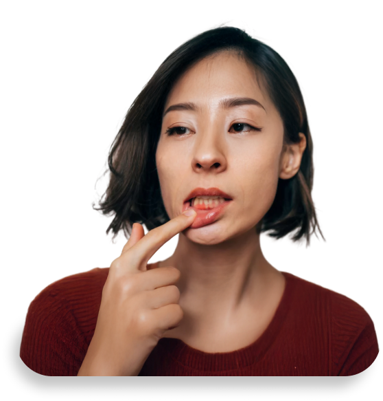 bleeding gums