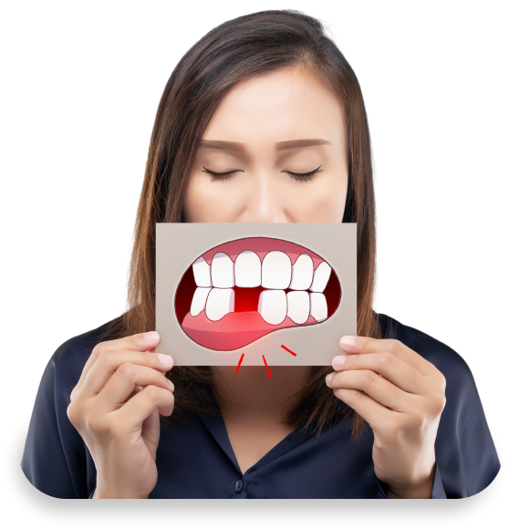 Missing 
Teeth
